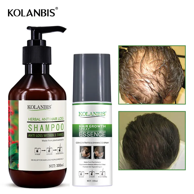 2 pudeles vīriešiem pret matu izkrišana šampūni un augu augšanas toniku būtība komplekts taukainai rudenī baldness regrowth matu izkrišana ārstēšana