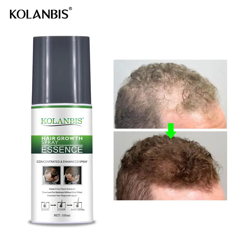 2 pudeles vīriešiem pret matu izkrišana šampūni un augu augšanas toniku būtība komplekts taukainai rudenī baldness regrowth matu izkrišana ārstēšana